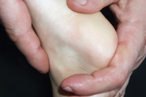 El masaje es uno de los muchos remedios naturales para la tendonitis de Aquiles.