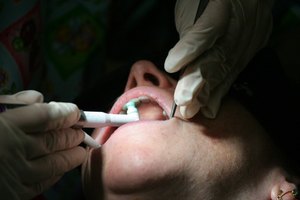 Ambos procedimientos reducen la inflamación en y por debajo de las encías.