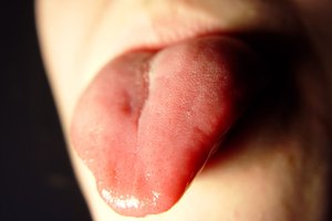 Tu lengua puede albergar muchos gérmenes que causan mal aliento.