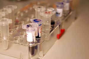 Las pruebas de LDH pueden indicar daño del tejido.