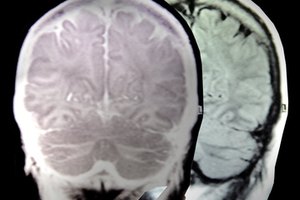 La lecitina juega un papel en la función del cerebro.