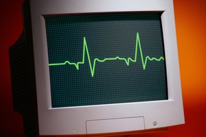 Los monitores de ritmo cardíaco son accesorios de ejercicio diseñados para rastrear lo duro que está trabajando tu corazón cuando haces ejercicio.