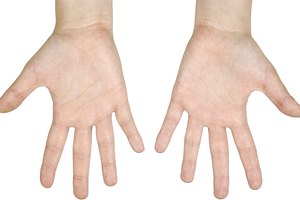 Abrir las manos lo más que puedas es una manera de fortalecer los músculos extensores.