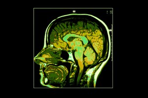 Los ácidos grasos omega-3 también son indispensables para el cerebro.