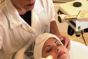 Exfoliante químico