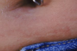 Los aretes en los pezones y el ombligo están entre los más populares.