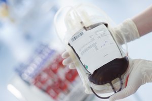 Las transfusiones de sangre pueden causar que un exceso de hierro se acumule en el cuerpo.