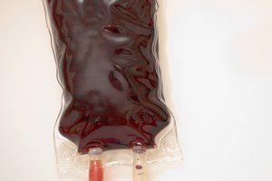 Examinar la sangre.
