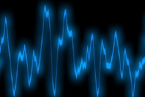 El ritmo irregular en el corazón a la larga conlleva peligros.