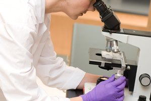 La biopsia prostática es la única manera definitiva de diagnosticar el cáncer de próstata.