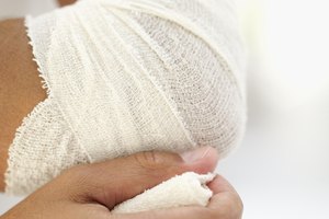 El método de tratamiento DECE consiste en Descansar, Enfriar, Comprimir y Elevar el codo afectado.