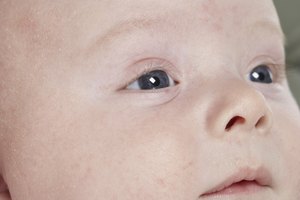 En ocasiones la piel de los bebés luce azulada en climas fríos.