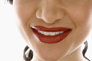 Herpes labial.