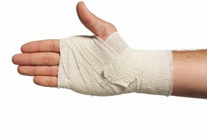 Las lesiones en la mano pueden causar la atrofia muscular.