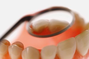 La erosión dental es una de las principales preocupaciones sobre la exposición prolongada de los dientes a las bebidas ácidas.
