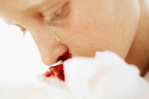 Calmar a tu hijo ayuda a detener el flujo de sangre.
