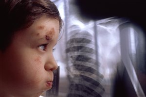 El abuso infantil y la negligencia son los peores ejemplos de una mala crianza.