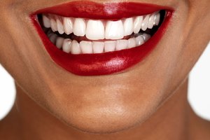 Existen tratamientos odontológicos para blanquear los dientes.