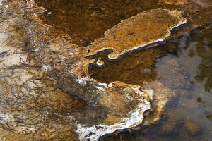 Algunas enfermedades causadas por bacterias pueden ser mortales.