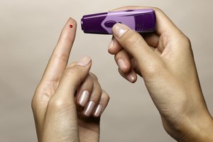 Uno de los síntomas de la diabetes es la presencia de glucosa en la orina.