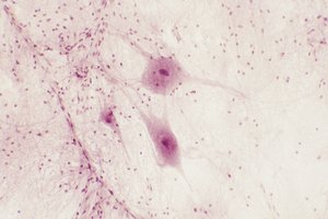 Neuronas magnificadas a 200 veces su tamaño.