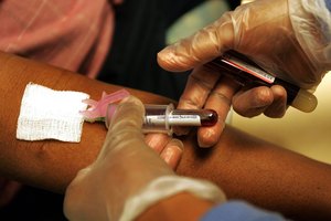 La orina de color rojo es un síntoma de altos niveles de proteínas.