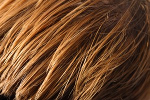Crecimiento del cabello.