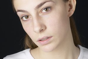 La actividad física puede ayudar a reducir la fatiga que genera la anemia.