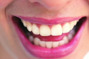A diferencia del azúcar común de mesa, el ace-K no provoca caries dentales.