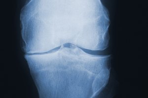 Las dietas altas en azúcar pueden elevar los niveles de mensajeros inflamatorios conocidos como citoquinas.