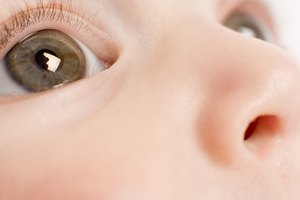 La conjuntivitis es común, contagiosa y por lo general se cura fácilmente.