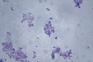 También es usado como una hierba que combate los virus.