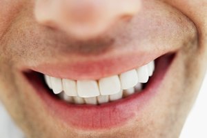 Tomar vinagre de manzana todos los días puede erosionar tu esmalte dental.