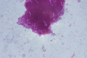 La bacteria Serratia puede ocasionar brotes en un hospital.