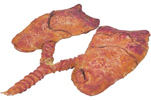 El exceso de hierro en el cuerpo puede dar lugar a una condición llamada edema pulmonar.