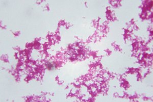 El virus del herpes zóster puede permanecer inactivo por décadas.