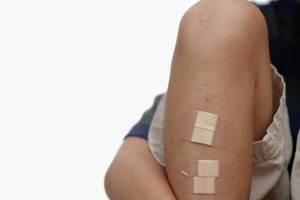 Los vendajes adhesivos pueden prevenir que se formen costras.