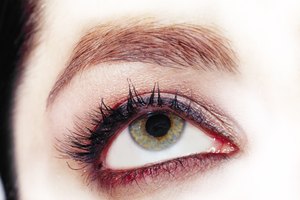 Las ojeras pueden producirse por una gran cantidad de factores.