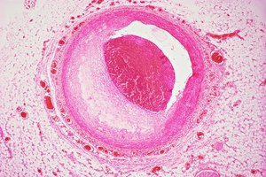 Vista microscópica de la arteria coronaria.