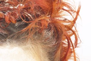 El cabello teñido puede tratarse para acabar con la caspa.