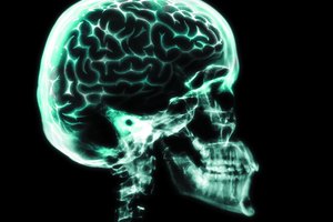 El sistema nervioso central incluye el cerebro, el tallo cerebral y la médula espinal y es la infraestructura principal de la comunicación eléctrica en el cuerpo.