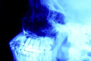 Photos.com/AbleStock.com/Getty Images Medical professionals who take X-rays are called radiographers and are a type of radiologic technician.