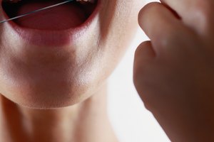 Habla con tu dentista acerca de unir con compuesto.