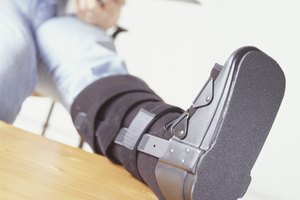 La rehabilitación correcta de una ruptura del tendón de Aquiles lleva meses.