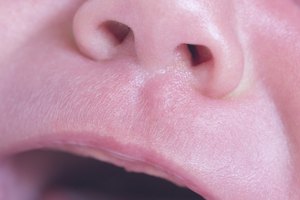 La solución medicinal para calmar cólicos contiene ciertas hierbas utilizaras para aliviar los problemas de la barriga.