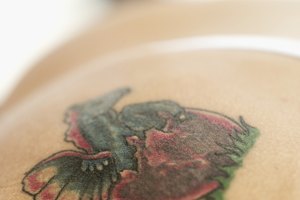 Es posible eliminar tatuajes sin recurrir al láser.