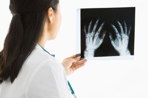 Los rayos x ayudan a diagnosticar el dolor de articulaciones.