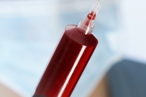 Las muestras proporcionadas son examinadas inicialmente para abusos de drogas serios.