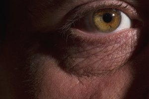 Las arvejas secas son ricas en vitamina A que ayuda a prevenir problemas con la visión.