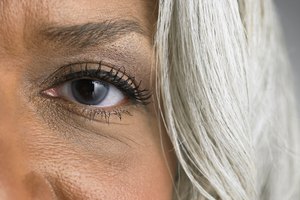 La fiebre del heno podría ser una causa de las ojeras.